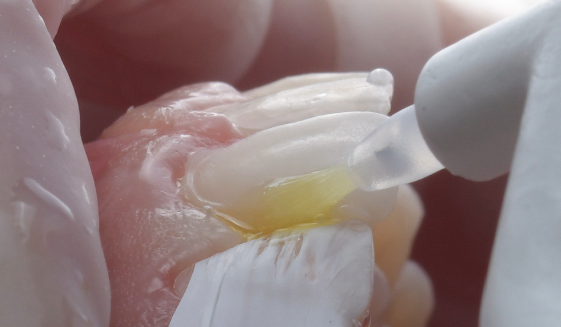 Bonding in Minimally Invasive Repair Procedures